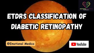 ETDRS Classification of Diabetic Retinopathy  Eye  emotionalmedico [upl. by Nanyt385]