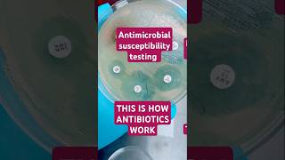 Antibiotic susceptibility testing is the measurement of how susceptible bacteria are to antibiotics [upl. by Legnaros]