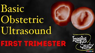 Basic Obstetric Ultrasound First Trimester Pregnancy [upl. by Tarah]