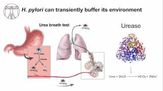 Gastritis H Pylori Persistence [upl. by Hourigan33]