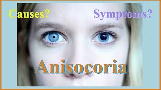 anisocoria [upl. by Beverlee]