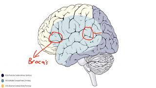 Aphasia and Neglect  health related videoeducation purple video [upl. by Daphne]