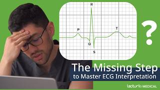 Crack the Code of ECGs The Missing Step Explained 🫀🔍 [upl. by Aelhsa]