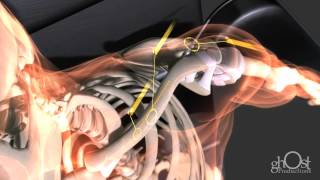 Heal  The medical animation of extreme trauma and repair  5th Anniversary [upl. by Olsson346]