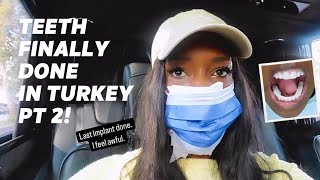 Finishing My Teeth In Turkey PT 2 [upl. by Dulcy]