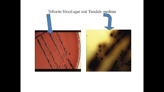 Tellurite blood agar and Tinsdale medium with growth of Corynebacterium diphtheriae [upl. by Drofhsa]