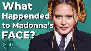 What Happened to Madonna’s Face [upl. by Louth]