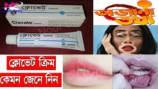 ক্লোভেট ক্রিম এর কাজ । Clovate ointment ব্যবহারের নিয়ম উপকারিতা ও অপকারিতার দিক  Noor Care [upl. by Raamaj]