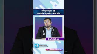 Diagnosis Of Megaloblastic Anemia  Quick Bites Internal medicine Hematology [upl. by Arayt]