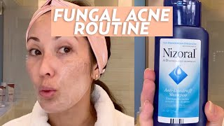 Treat Fungal Acne With This Skincare Routine  SKINCARE [upl. by Yaf]