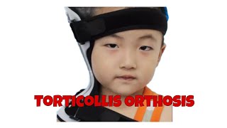 Torticollis orthosis  neck correction suport koreksi leher miring anak [upl. by Hinman]