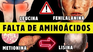 SINAIS DE ALERTA de DEFICIÃŠNCIA dos 9 AMINOÃCIDOS ESSENCIAIS  Dr Alain Dutra [upl. by Johppah989]