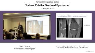 Lateral Patellar Overload Syndrome [upl. by Urias]