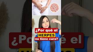 ¿Por qué es herpes no tiene cura👩🏻‍⚕️ herpes salud medicina interesante sabíasque [upl. by Airlee]