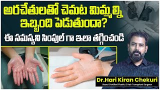 Hyperhidrosis Treatment in Telugu  How to Cure Sweaty Palms Permanently  ReDefine Channel [upl. by Enilamme]