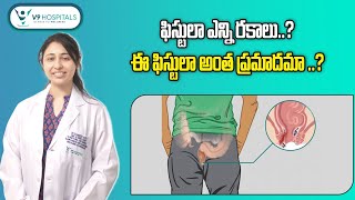 Types Of Perianal Fistula And Causes Symptoms Diagnosis amp Treatment in Telugu  V9 Hospitals [upl. by Cence]