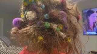 6YearOld Gets 150 Bunchems Velcro Balls Stuck in Her Hair [upl. by Flatto]