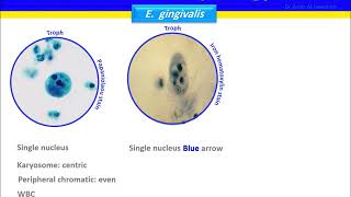 Entamoeba gingivalis [upl. by Cherin]