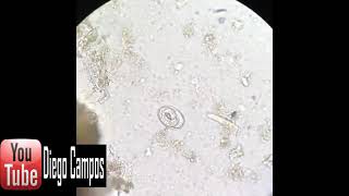 Ancylostoma duodenale egg [upl. by Byrom]