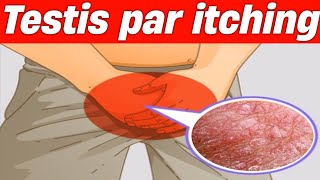 Testis par itching Scrotal itching ka treatment [upl. by Orgell]