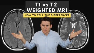 T1 vs T2 weighted MRI images How to tell the difference [upl. by Dorahs]