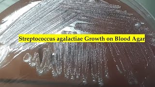 Streptococcus agalactiae Growth on Blood Agar Urine Culture Findings [upl. by Austreng]