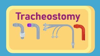 What is Tracheostomy [upl. by Anayhd]