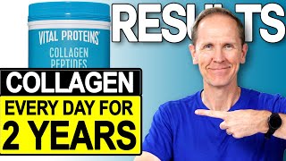 Vital Proteins Collagen Peptides  Results After 2 Years [upl. by Gard]