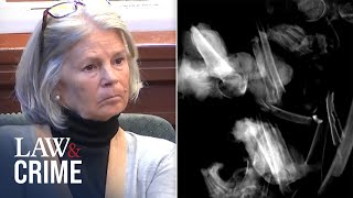 Medical Examiner Presents XRay Bone Fragments Found in Fire Pit [upl. by Notterb485]