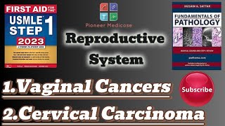 Usmle step 1Vaginal tumorsCervical carcinoma from PathomaReproductive system pathologyUrduHindi [upl. by Etnelav242]