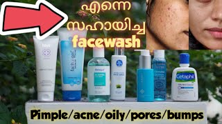 🔴Best Facewash for Acne and One was Doctor recommended  OilyPimples [upl. by Knight674]