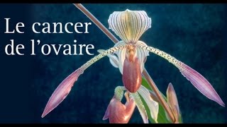 Cancer de lOvaire  Signes et symptômes [upl. by Harim689]