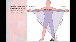 12 Lead Interpretation Part 1 Introduction to the 12 Lead EKG [upl. by Ahseiyk570]