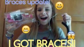 BracesHeadgear UpdateI GOT BRACES 2 [upl. by Yrroc]