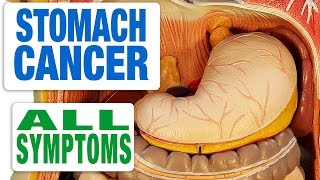 Stomach Cancer  All Symptoms [upl. by Nelleeus]