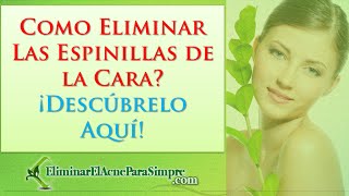 Como Eliminar Las Espinillas de la Cara ¡Descubrelo Aquí [upl. by Shiller]