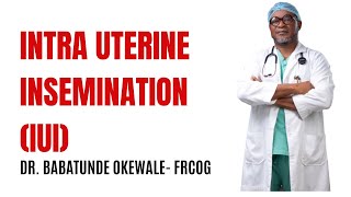 Intra Uterine Insemination IUI [upl. by Itnahs784]