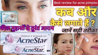 Acnestar gel for acne pimples कील मुंहासों से तुरंत आराम असरदार दवाई youtubeviralvideo ytvideo [upl. by Heriberto]