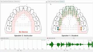 SmartPalate EPG System Demo [upl. by Amleht]