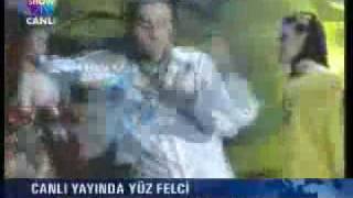 Ismail YK Yüz FeLçi Haberi  Show tw [upl. by Edelson57]