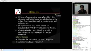 Community dentistry  Caries Detection Tests  Preventive Dentistry  Dr Shweta [upl. by Archambault]