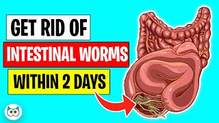 Use These Natural Methods To Get Rid of Intestinal Worms Within Two Days [upl. by Kirk559]