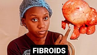 FIBROIDS What is the Cause Tell Signs Medication Options Available amp When to Opt for Surgery [upl. by Duncan226]