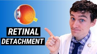 Retinal Detachment Symptoms and Treatment  How Retinal Detachment is Treated [upl. by Glennon]