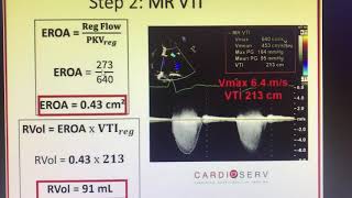 Mitral regurgitation EROA [upl. by Ayhdiv]