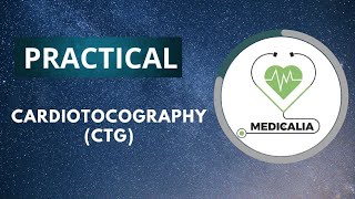 Cardiotocography  CTG   part 2 [upl. by Namolos]