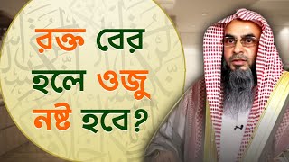 রক্ত বের হলে কি ওজু নষ্ট হয় Sheikh Motiur Rahman Madani [upl. by Uv690]