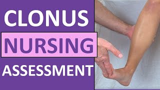 Clonus Test Positive Reflex Sign Preeclampsia Pregnancy  Nursing Skills [upl. by Aral]