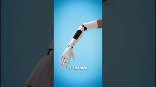 How a robotic Hand Work Robotic Hand Surgery sciencefacts shorts [upl. by Fayette215]