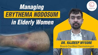 Understanding Erythema Nodosum in Geriatric Women  Dr Rajdeep Mysore  Charma Clinic [upl. by Anetta128]